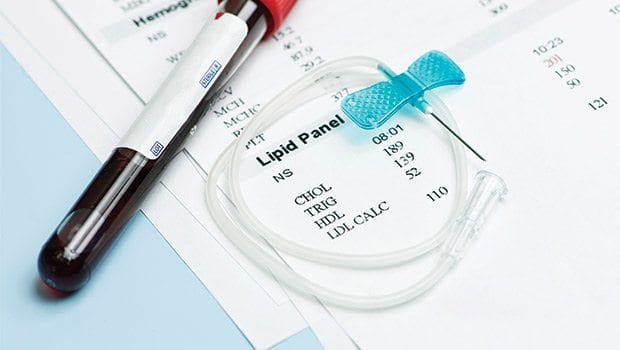 Screening tests for cholesterol